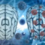 La sindrome Long COVID e gli effetti psicologici della malattia